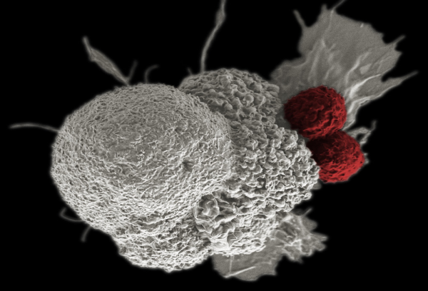 Cancer Immunotherapy Market Analysis and Forecast to 2030 Report