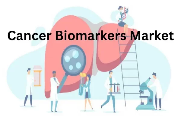 Cancer Biomarkers Market Analysis and Forecast to 2030 Report